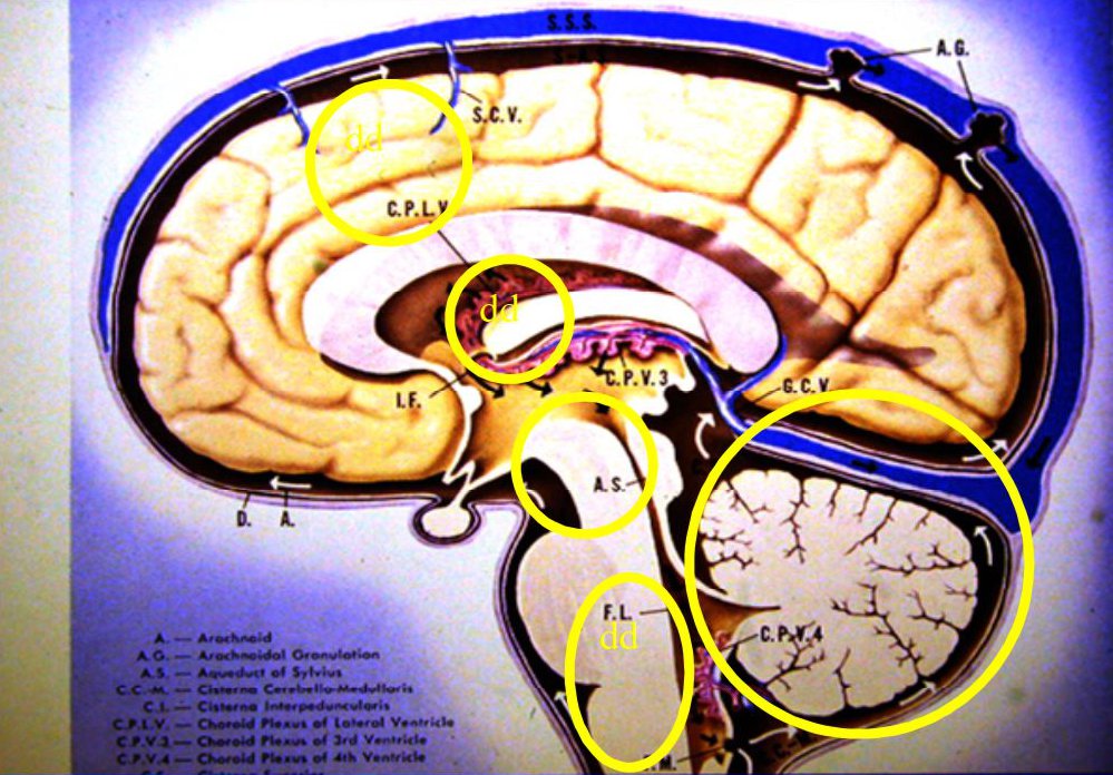 human brain with areas circled
